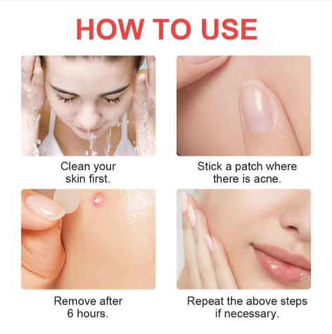 ACNE COVER PATCH