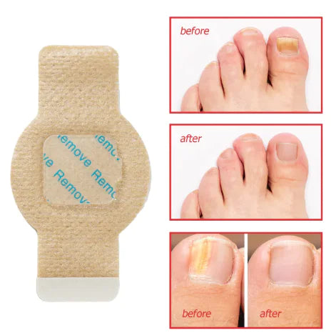 Nail Health Antibacterial Shield