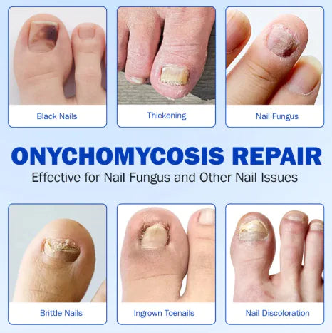Nail Health Antibacterial Shield