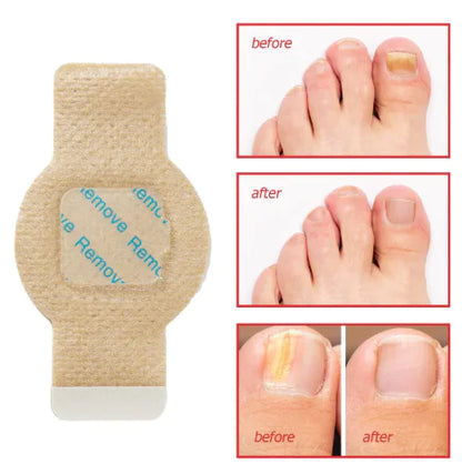 Nail Health Antibacterial Shield
